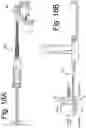 Fig. 26 - DEVICES AND METHODS FOR SPINAL IMPLANTATION