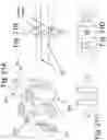 Fig. 32 - DEVICES AND METHODS FOR SPINAL IMPLANTATION