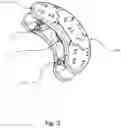 Fig. 03 - Artificial disc system