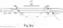 Fig. 10 - Artificial disc system