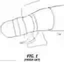 Fig. 02 - Modular adjustable prosthetic volume compensation system