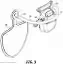 Fig. 04 - Modular adjustable prosthetic volume compensation system