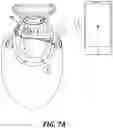 Fig. 09 - Modular adjustable prosthetic volume compensation system