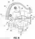 Fig. 10 - Modular adjustable prosthetic volume compensation system