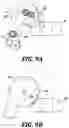 Fig. 11 - Modular adjustable prosthetic volume compensation system