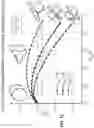 Fig. 07 - Self-expandable stent, method and device to produce the self-expandable stent