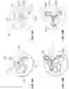 Fig. 09 - Self-expandable stent, method and device to produce the self-expandable stent