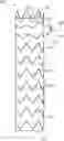 Fig. 01 - Branched stent graft