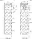 Fig. 04 - Branched stent graft