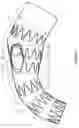 Fig. 04 - Thoracic aorta stent graft with access region