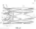 Fig. 04 - STENT DEVICE INCLUDING A FLARABLE CROWN