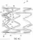 Fig. 08 - STENT DEVICE INCLUDING A FLARABLE CROWN