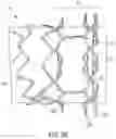 Fig. 50 - STENT DEVICE INCLUDING A FLARABLE CROWN