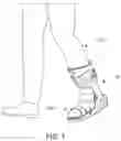 Fig. 02 - REAR ENTRY WALKER