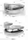 Fig. 02 - Mandibular advancement device