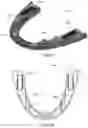 Fig. 05 - Mandibular advancement device