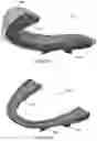 Fig. 07 - Mandibular advancement device