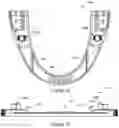 Fig. 08 - Mandibular advancement device
