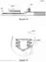 Fig. 09 - Mandibular advancement device