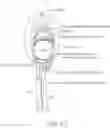 Fig. 13 - DEVICE AND METHOD OF PERFORMING CERCLAGE SACROCERVICOPEXY
