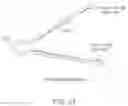 Fig. 14 - DEVICE AND METHOD OF PERFORMING CERCLAGE SACROCERVICOPEXY