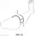 Fig. 11 - DEFORMABLE THERMAL PACK