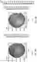 Fig. 34 - Methods, Computer-Readable Media, and Systems for Treating a Cornea