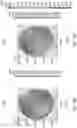 Fig. 35 - Methods, Computer-Readable Media, and Systems for Treating a Cornea