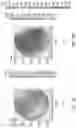 Fig. 37 - Methods, Computer-Readable Media, and Systems for Treating a Cornea