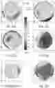 Fig. 47 - Methods, Computer-Readable Media, and Systems for Treating a Cornea