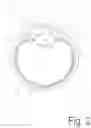 Fig. 03 - CORNEAL REFRACTIVE CORRECTION USING  A SURFACE TREATMENT AFTER CORNEAL RESHAPING