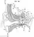 Fig. 02 - Inner ear plug