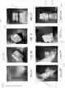 Fig. 10 - ENHANCED TRAUMA BANDAGE
