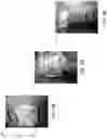 Fig. 11 - ENHANCED TRAUMA BANDAGE