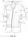 Fig. 02 - Inflation-Mediated Pressure Therapy Garment