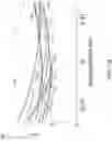 Fig. 21 - Systems and Methods for Determining Compression Depth and Providing Feedback During Active Compression Decompressions