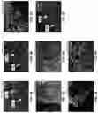 Fig. 08 - Pulp regeneration compositions and methods of forming and using the same