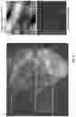 Fig. 14 - ORAL CARE NANOPARTICLE COMPOSITIONS AND METHODS