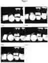 Fig. 17 - ANTIBODY FORMULATIONS