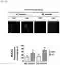 Fig. 20 - Nanohelix-substrate complex for controlling macrophage behavior, preparation method thereof, and method of controlling adhesion and polarization of macrophage by using the same