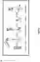 Fig. 05 - SYNTHETICALLY LETHAL NANOPARTICLES FOR TREATMENT OF CANCERS