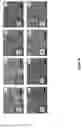 Fig. 06 - SYNTHETICALLY LETHAL NANOPARTICLES FOR TREATMENT OF CANCERS