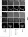 Fig. 07 - SYNTHETICALLY LETHAL NANOPARTICLES FOR TREATMENT OF CANCERS