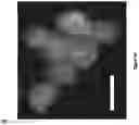 Fig. 08 - SYNTHETICALLY LETHAL NANOPARTICLES FOR TREATMENT OF CANCERS