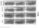 Fig. 22 - SYNTHETICALLY LETHAL NANOPARTICLES FOR TREATMENT OF CANCERS