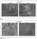 Fig. 12 - COMPOSITION FOR THE TREATMENT OF PSORIASIS