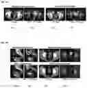 Fig. 13 - Methods for treating cancer