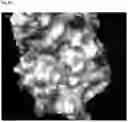 Fig. 51 - Methods for treating cancer
