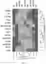 Fig. 14 - Method of treating cancer using selective estrogen receptor modulators