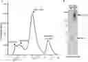 Fig. 01 - Methods of treating IgA nephropathy with thiol-containing molecules